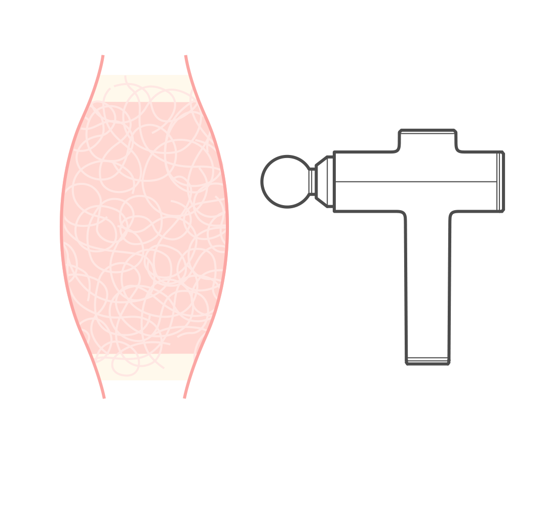 拿筋膜枪按摩眼睛?有人拿它
