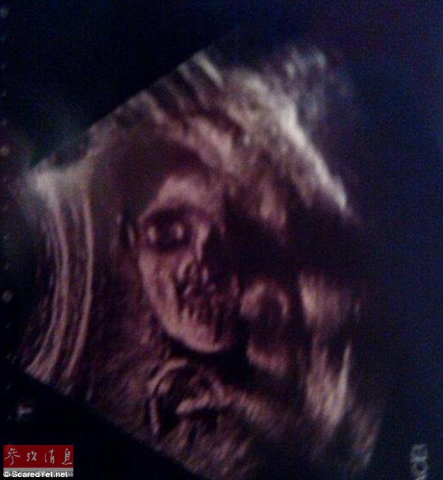 而这个胎儿有着完整的鹰钩鼻和长长的"利爪",从图像看来像是邪恶的