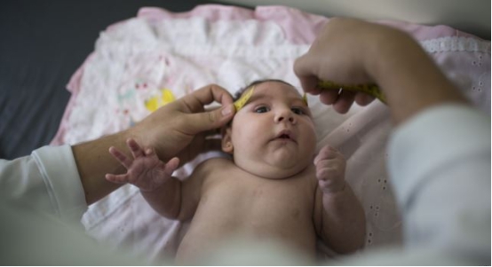自10月份以来，巴西的“新生儿小头畸形症”案例已增至4180例