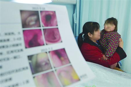 患有罕见病症的3岁女童在医院等待手术/晨报记者 朱影影