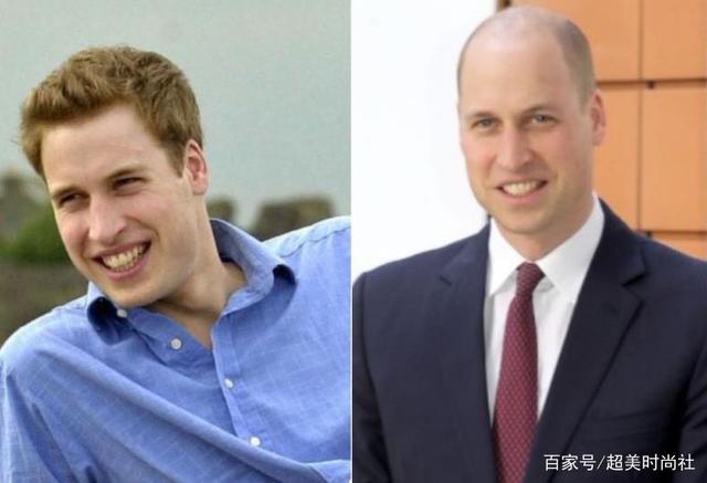 威廉王子|脑门光亮却不植发!威廉王子被评为最性感秃顶男人,网友不服