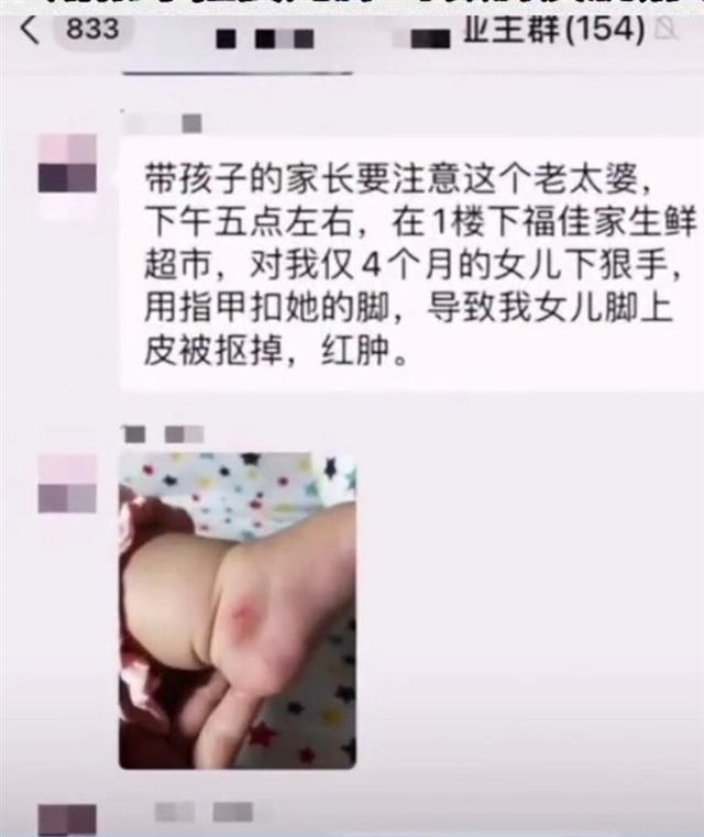 治安管理处罚法|不满婴儿车挡道，一大妈竟抠掉婴儿脚皮，现已被厦门警方拘留