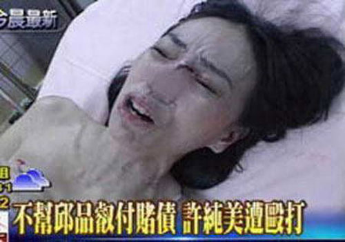 许纯美