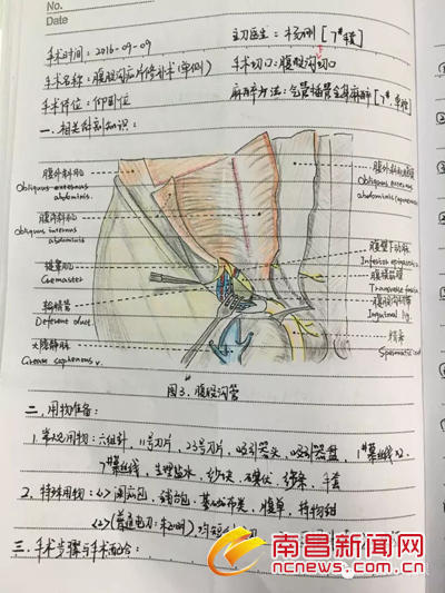 90後美女護士手術筆記走紅 字跡工整解剖圖手繪