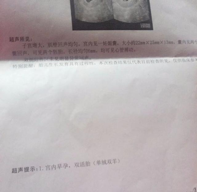 #养孩子#浙江男子带老婆做孕检，一查肚子里竟有4个...网友算了笔帐，一般人真不知道