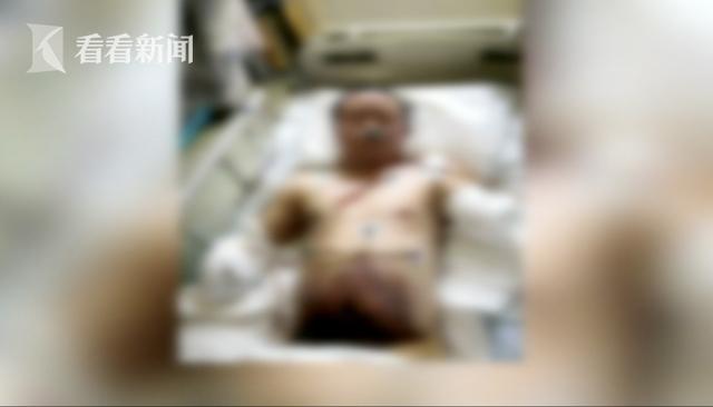 [Knews]帮孩子高压线上取风筝，这对夫妻受电击双双截肢