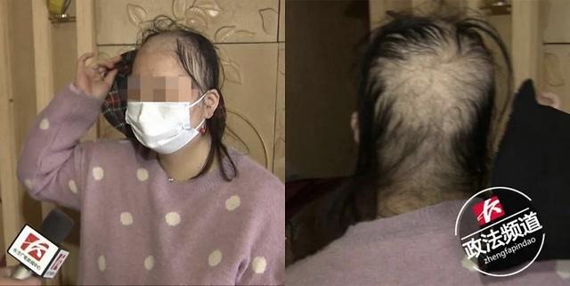 【秃头】长沙一女子从养发馆出来后变“秃头”，戴上帽子才敢出门！店家这么回应……