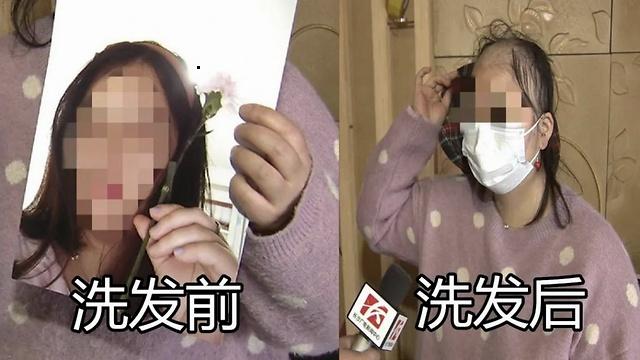 【秃头】长沙一女子从养发馆出来后变“秃头”，戴上帽子才敢出门！店家这么回应……