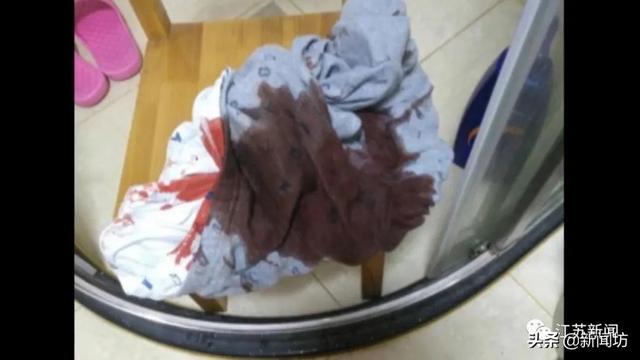 『下消化道出血』血飙到满床都是!8岁男孩深夜发病,竟是因为TA掉出来了