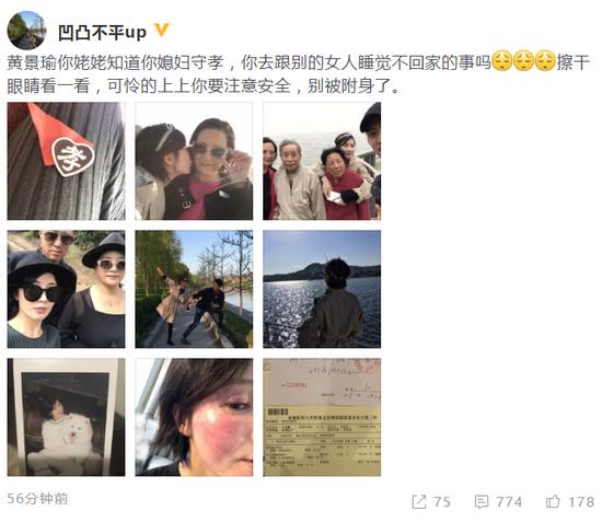 前女友：曝黄景瑜前女友自杀未遂 网友：演技好真能忽略人品？