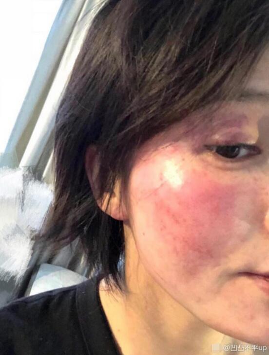 前女友：曝黄景瑜前女友自杀未遂 网友：演技好真能忽略人品？