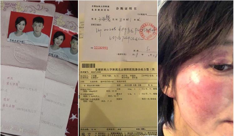 女方■晒出王雨馨黄景瑜结婚证及女方受伤照!助理再发文回应,这次实锤了吗?