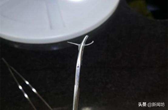 拔根鱼刺40块,医生被投诉“乱收费”!网友怒怼:捡条命真便宜