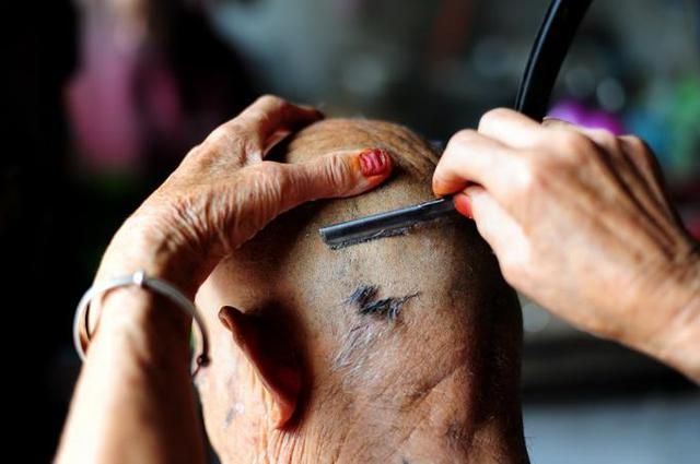 暗访|新华社暗访植发市场 技术包装蒙外行“速成医生”浑水摸鱼