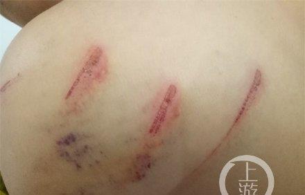 起诉离婚|妇联回应女子5年4次起诉离婚被驳 发生在民法典生效前 已提第五次诉讼