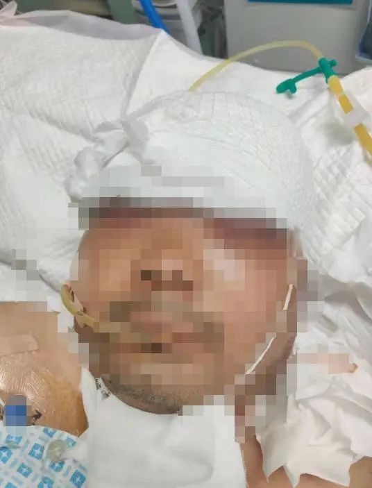 充气|惨剧！银川一男子给轮胎充气发生爆炸，头部血肉模糊左眼爆裂