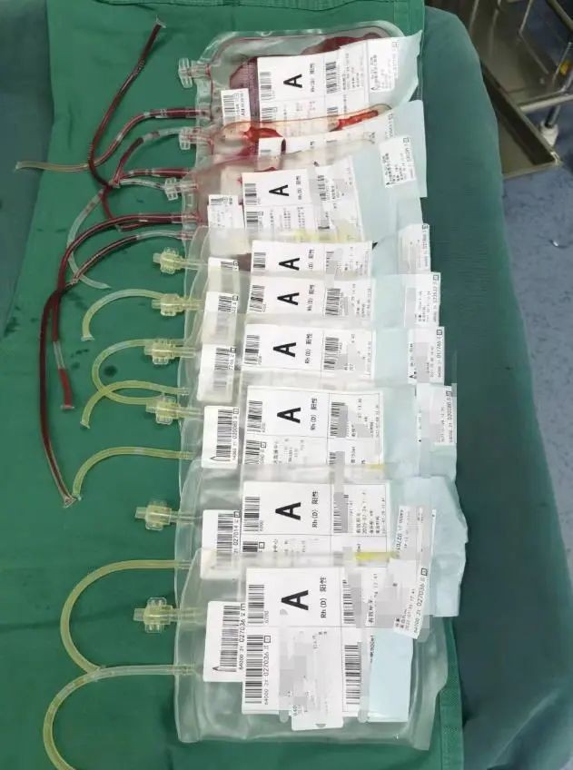 充气|惨剧！银川一男子给轮胎充气发生爆炸，头部血肉模糊左眼爆裂