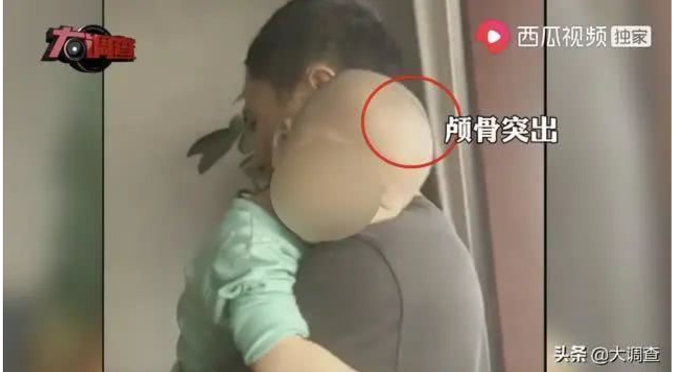 【医生】又爆“大头娃娃”事件!官方:未发现医生参与假奶粉事件