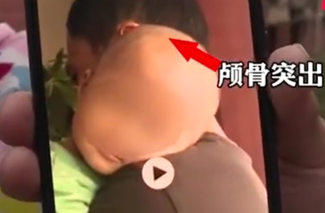 爱婴坊■饮料当奶粉？ 郴州推荐假奶粉涉事医生被停职 官方介入调查
